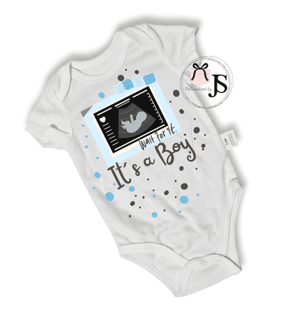 Baby Romper: Gepersonaliseerde Romper met Echte Echo Foto - Personalized by JS
